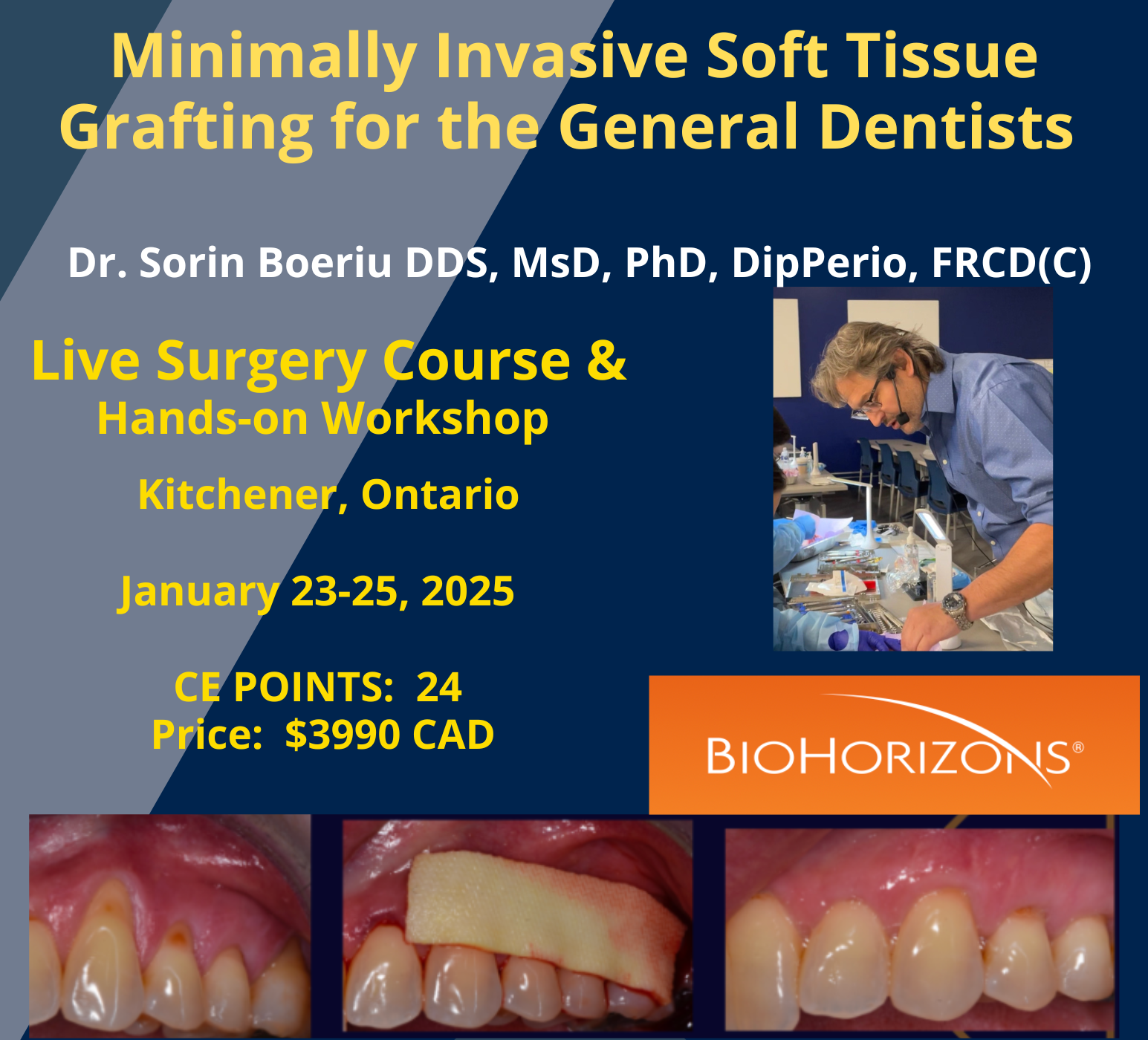 Soft-Tissue Surgery in Aesthetic Dentistry